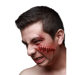 Blessure Points De Sutures En Latex